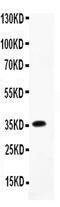 C-C Motif Chemokine Ligand 7 antibody, PA5-78940, Invitrogen Antibodies, Western Blot image 