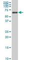 AKT Serine/Threonine Kinase 2 antibody, H00000208-M03, Novus Biologicals, Western Blot image 