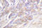TNF Receptor Superfamily Member 1A antibody, LS-C176354, Lifespan Biosciences, Immunohistochemistry paraffin image 