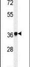 Neutrophil Cytosolic Factor 4 antibody, PA5-14593, Invitrogen Antibodies, Western Blot image 