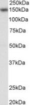 Nuclear Factor Of Activated T Cells 3 antibody, MBS423271, MyBioSource, Western Blot image 