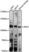 Polycystin 2, Transient Receptor Potential Cation Channel antibody, GTX32799, GeneTex, Western Blot image 