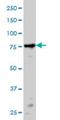 Protein Kinase C Alpha antibody, H00005578-M01, Novus Biologicals, Western Blot image 