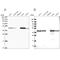 Succinate-CoA Ligase GDP-Forming Beta Subunit antibody, PA5-62527, Invitrogen Antibodies, Western Blot image 