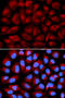 FA Complementation Group C antibody, STJ23623, St John