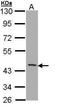 T-cell surface glycoprotein CD1b antibody, GTX112817, GeneTex, Western Blot image 