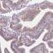 Dynein Regulatory Complex Subunit 3 antibody, NBP1-84128, Novus Biologicals, Immunohistochemistry paraffin image 