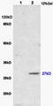 NUAK Family Kinase 1 antibody, orb100340, Biorbyt, Western Blot image 