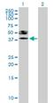 ST6 N-Acetylgalactosaminide Alpha-2,6-Sialyltransferase 6 antibody, H00030815-B02P, Novus Biologicals, Western Blot image 