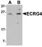 ECRG4 Augurin Precursor antibody, MBS151199, MyBioSource, Western Blot image 