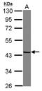 Snurportin 1 antibody, LS-C155410, Lifespan Biosciences, Western Blot image 