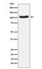 cGMP-dependent 3 ,5 -cyclic phosphodiesterase antibody, M03472-2, Boster Biological Technology, Western Blot image 