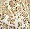 Eukaryotic Translation Initiation Factor 4E antibody, LS-C167701, Lifespan Biosciences, Immunohistochemistry paraffin image 