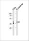 Isocitrate Dehydrogenase (NAD(+)) 3 Beta antibody, A09433-2, Boster Biological Technology, Western Blot image 