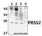Serine Protease 2 antibody, GTX66818, GeneTex, Western Blot image 