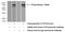 Carboxypeptidase Z antibody, 15944-1-AP, Proteintech Group, Western Blot image 