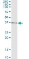 Aldo-Keto Reductase Family 7 Member A2 antibody, H00008574-M15, Novus Biologicals, Immunoprecipitation image 