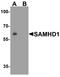 SAM And HD Domain Containing Deoxynucleoside Triphosphate Triphosphohydrolase 1 antibody, TA355002, Origene, Western Blot image 