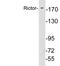 RPTOR Independent Companion Of MTOR Complex 2 antibody, LS-C291733, Lifespan Biosciences, Western Blot image 