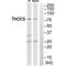 THO Complex 5 antibody, PA5-50160, Invitrogen Antibodies, Western Blot image 