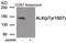 ALK Receptor Tyrosine Kinase antibody, 80-015, ProSci, Western Blot image 