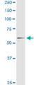 Retinoid X Receptor Alpha antibody, H00006256-M03, Novus Biologicals, Immunoprecipitation image 