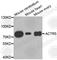 Actin Related Protein 5 antibody, A3505, ABclonal Technology, Western Blot image 