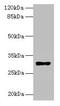 Major Histocompatibility Complex, Class II, DR Beta 4 antibody, CSB-PA03909A0Rb, Cusabio, Western Blot image 