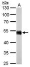 Aldehyde Dehydrogenase 1 Family Member A1 antibody, GTX123973, GeneTex, Western Blot image 