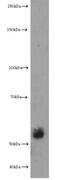 Extracellular Matrix Protein 1 antibody, abx112422, Abbexa, Enzyme Linked Immunosorbent Assay image 