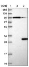 DIRAS Family GTPase 3 antibody, PA5-55898, Invitrogen Antibodies, Western Blot image 
