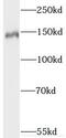 Synaptic Ras GTPase Activating Protein 1 antibody, FNab08437, FineTest, Western Blot image 