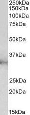 Chloride Intracellular Channel 1 antibody, PA5-37850, Invitrogen Antibodies, Western Blot image 