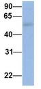 Interferon Induced Protein With Tetratricopeptide Repeats 5 antibody, GTX45362, GeneTex, Western Blot image 