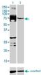 Serine/Threonine Kinase Like Domain Containing 1 antibody, H00169436-M03, Novus Biologicals, Western Blot image 