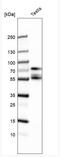 Sperm Adhesion Molecule 1 antibody, NBP1-81637, Novus Biologicals, Western Blot image 