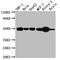 Tachykinin Receptor 1 antibody, CSB-RA555508A0HU, Cusabio, Western Blot image 