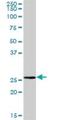 Biphenyl Hydrolase Like antibody, H00000670-B01P, Novus Biologicals, Western Blot image 