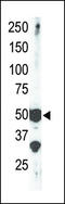 SET Domain Containing 7, Histone Lysine Methyltransferase antibody, LS-C98686, Lifespan Biosciences, Western Blot image 