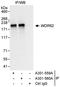 WD Repeat Domain 62 antibody, A301-559A, Bethyl Labs, Immunoprecipitation image 