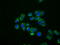 Interferon Induced Protein With Tetratricopeptide Repeats 1 antibody, GTX84315, GeneTex, Immunofluorescence image 