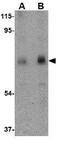Calpain 6 antibody, GTX85383, GeneTex, Western Blot image 