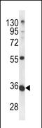 Methyltransferase Like 11B antibody, PA5-71714, Invitrogen Antibodies, Western Blot image 