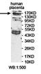 Rho GTPase Activating Protein 21 antibody, orb78400, Biorbyt, Western Blot image 