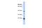 Penta-EF-Hand Domain Containing 1 antibody, PA5-44900, Invitrogen Antibodies, Western Blot image 