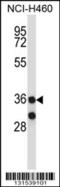  antibody, 57-285, ProSci, Western Blot image 