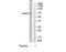 PARP2 antibody, TA315008, Origene, Western Blot image 