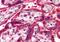 Nei Like DNA Glycosylase 1 antibody, PA5-18134, Invitrogen Antibodies, Immunohistochemistry frozen image 
