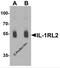 Interleukin 1 Receptor Like 2 antibody, 7501, ProSci Inc, Western Blot image 