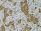 TNF Superfamily Member 13 antibody, LS-C331378, Lifespan Biosciences, Immunohistochemistry paraffin image 